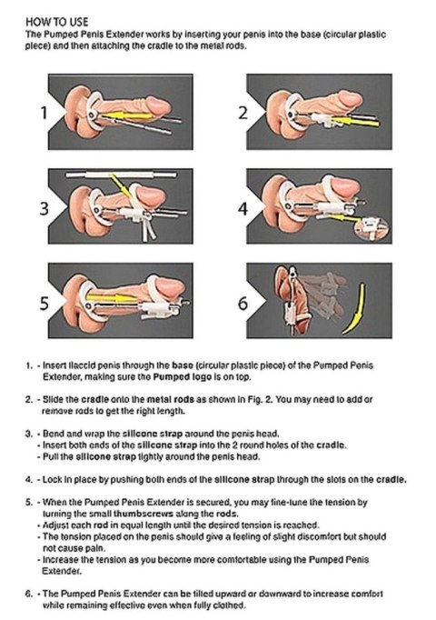 Penis Extender - White Penis Extender - White